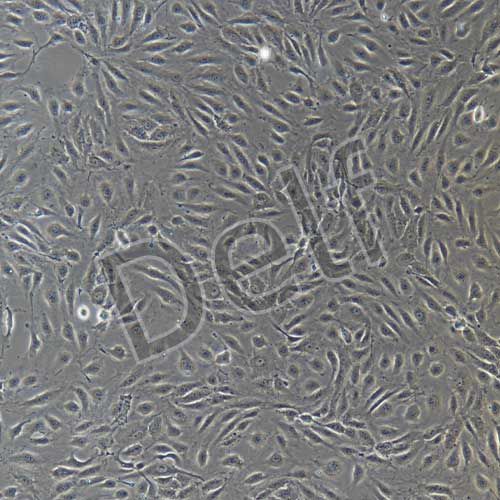 人原代腹膜微血管內(nèi)皮細(xì)胞