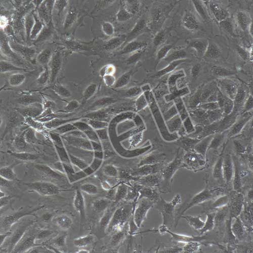 人原代腹膜微血管內(nèi)皮細(xì)胞