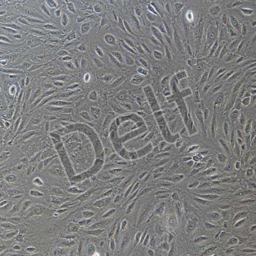 人肝竇內(nèi)皮細胞永生化