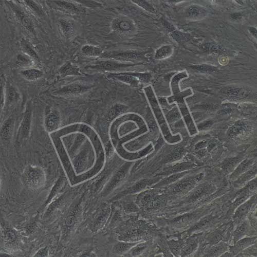 人肝竇內(nèi)皮細胞永生化