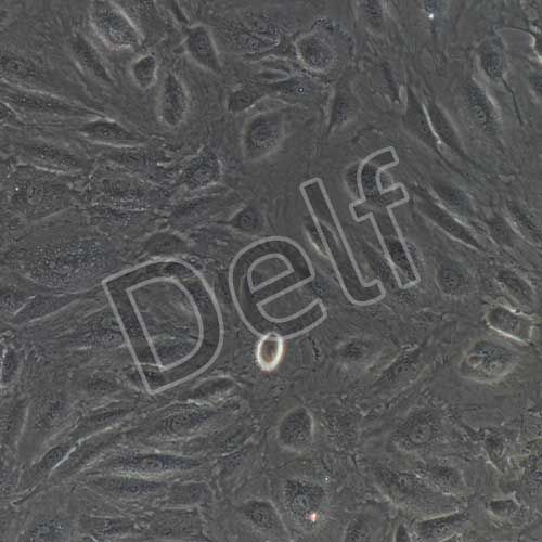 人肝竇內(nèi)皮細胞永生化