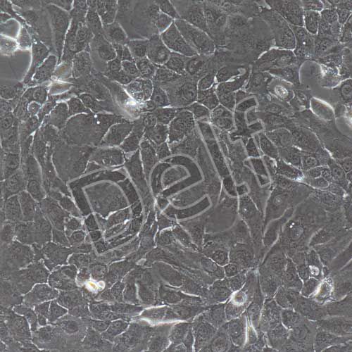 人原代宮頸上皮細(xì)胞