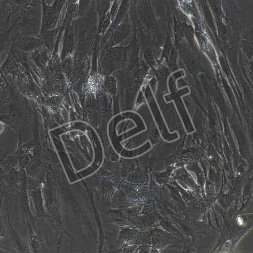 人骨骼肌細(xì)胞永生化-sv40