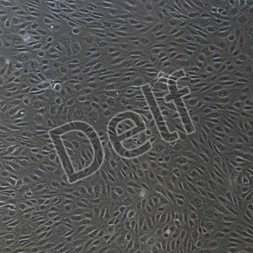 人原代骨骼肌微血管內(nèi)皮細(xì)胞