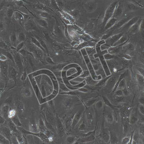 人原代骨微血管內皮細胞