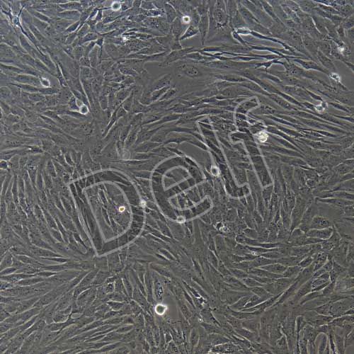 人原代冠狀動(dòng)脈平滑肌細(xì)胞