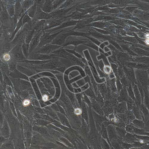 人原代冠狀動(dòng)脈平滑肌細(xì)胞