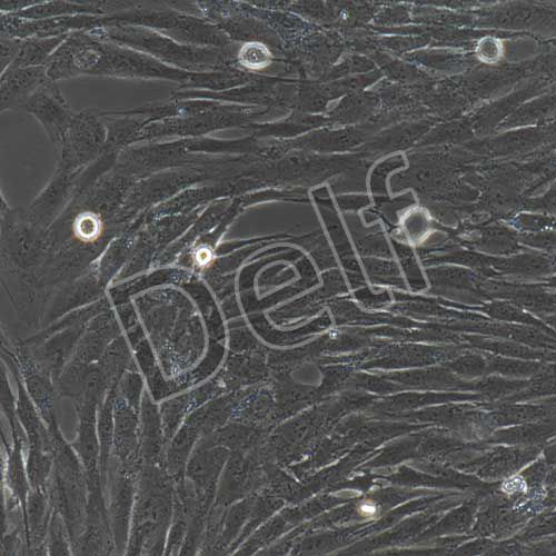 人原代冠狀動(dòng)脈平滑肌細(xì)胞