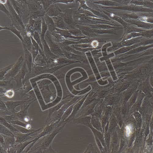 人原代甲狀腺成纖維細(xì)胞