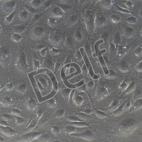 人原代甲狀腺微血管內(nèi)皮細胞