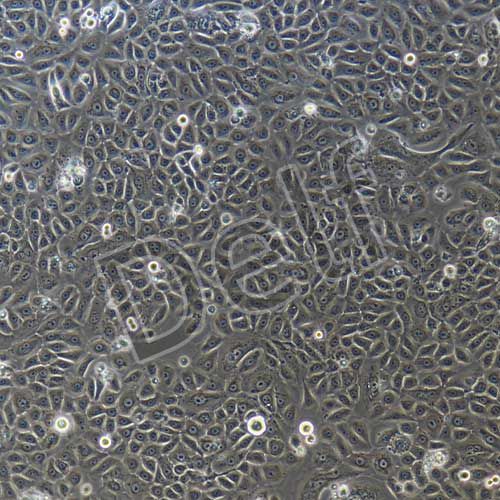 人原代角質(zhì)形成細胞