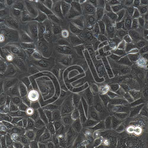 人原代角質(zhì)形成細胞