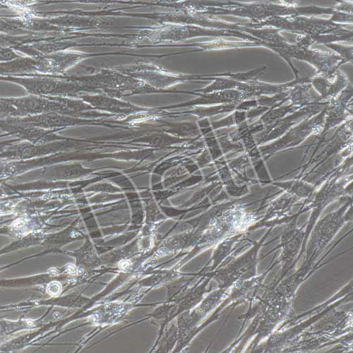 人頸靜脈球瘤細(xì)胞永生化