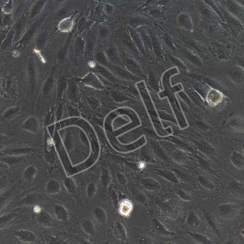 人原代淋巴管內皮細胞