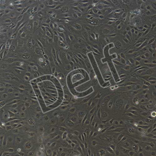 人淋巴管內(nèi)皮細(xì)胞永生化-sv40