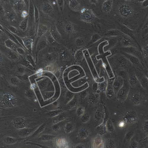 人淋巴管內(nèi)皮細(xì)胞永生化-sv40