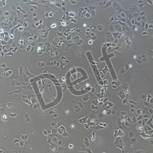 人卵巢癌細(xì)胞永生化