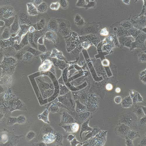 人卵巢癌細(xì)胞永生化