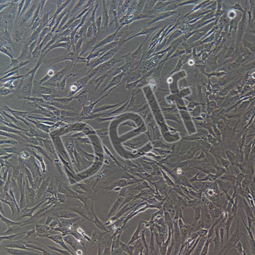 人前庭鞘膜瘤細(xì)胞永生化