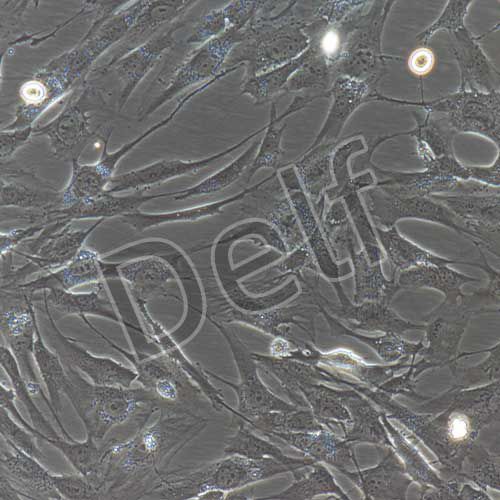 人前庭鞘膜瘤細(xì)胞永生化