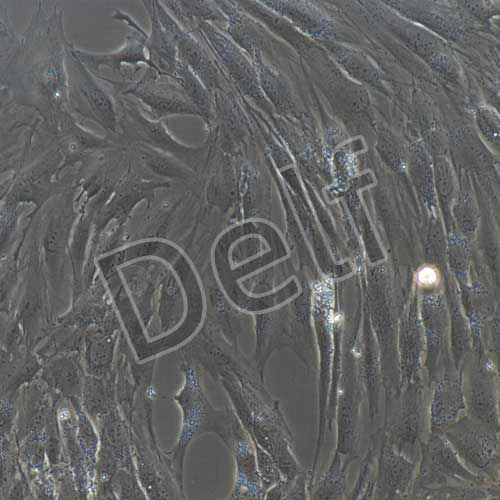 人乳腺癌成纖維細(xì)胞永生化