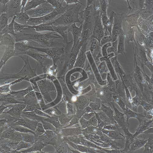 人原代乳腺成纖維細(xì)胞