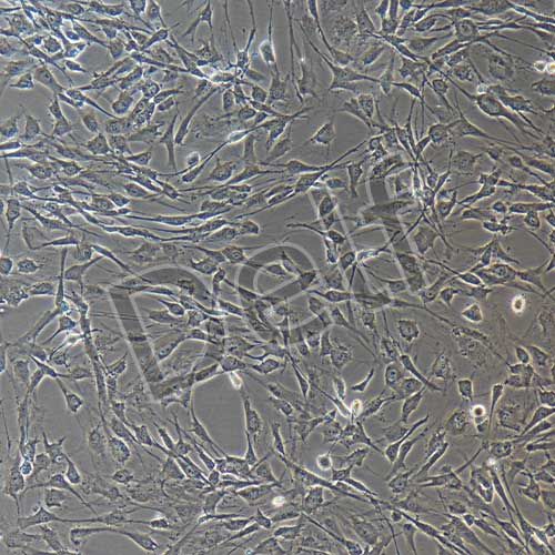 人神經(jīng)鞘膜瘤細胞永生化