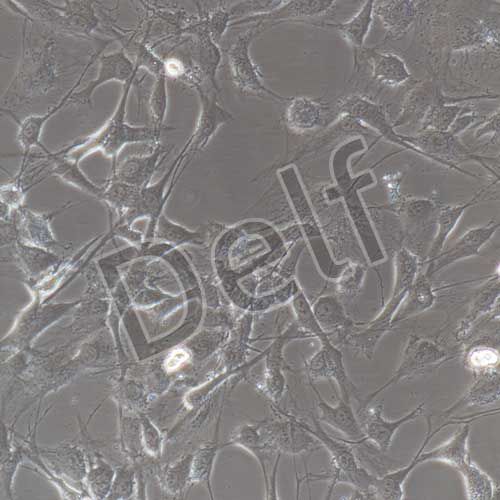 人神經(jīng)鞘膜瘤細胞永生化