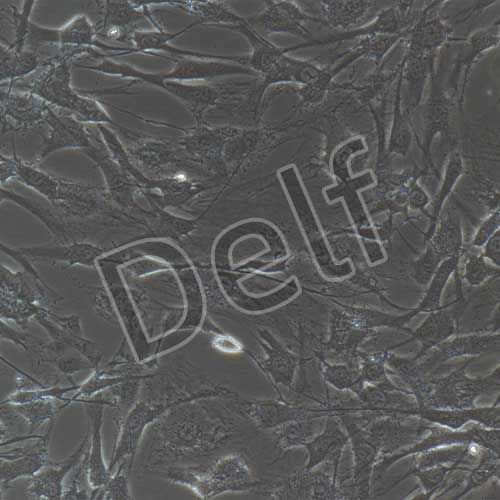 人神經(jīng)鞘膜瘤細胞永生化