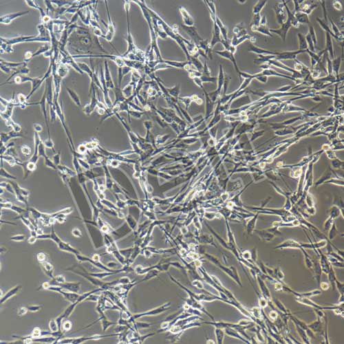 人腸息肉上皮細胞永生化