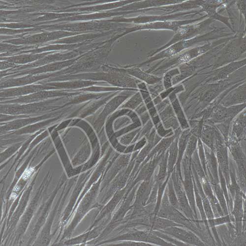 人原代牙周膜成纖維細胞