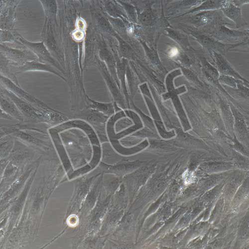 人原代眼眶成纖維細(xì)胞