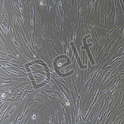 人原代胰腺星狀細胞