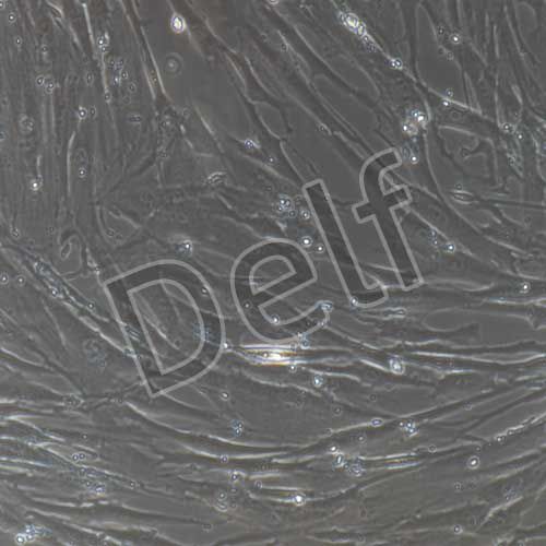 人原代胰腺星狀細胞