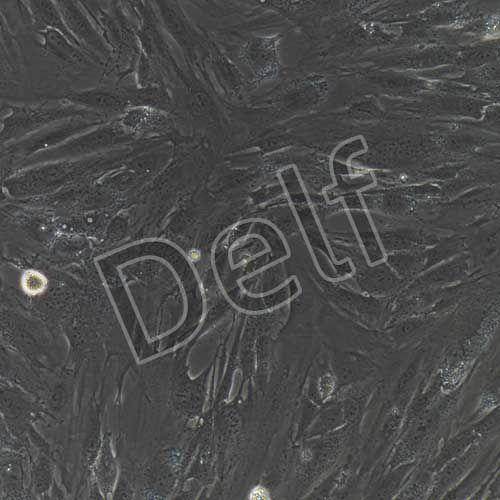 人胰腺腫瘤成纖維細胞永生化