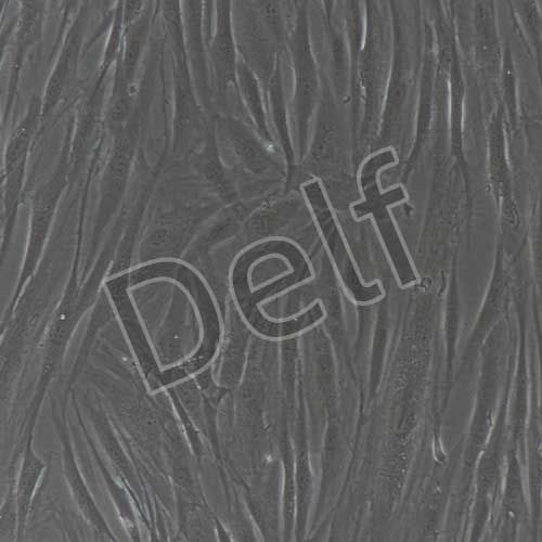 人原代增生性瘢痕成纖維細(xì)胞