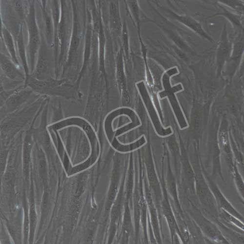 人原代增生性瘢痕成纖維細(xì)胞