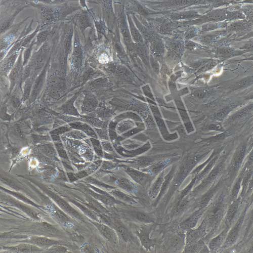 人支氣管平滑肌細胞永生化-sv40