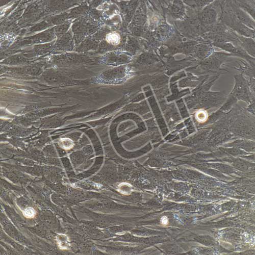 人支氣管平滑肌細胞永生化-sv40