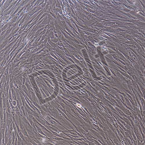 人原代主動(dòng)脈瓣膜間質(zhì)細(xì)胞