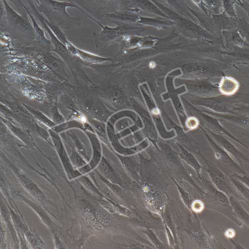 人主動(dòng)脈瓣膜間質(zhì)細(xì)胞永生化