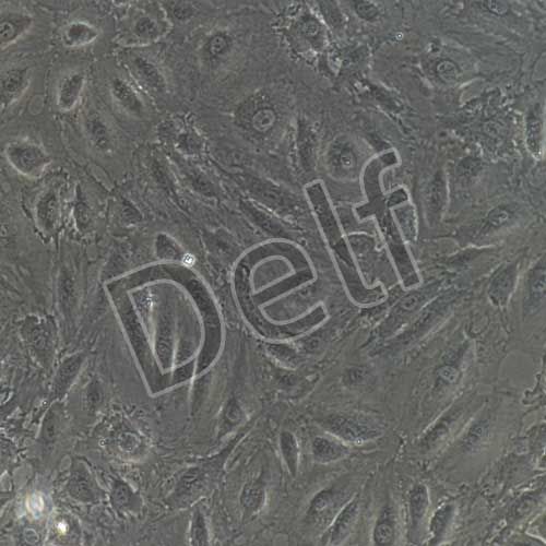 人主動脈內皮細胞永生化-sv40