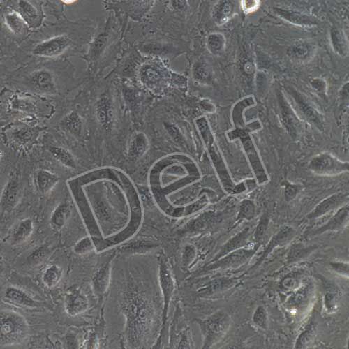 人主動脈內皮細胞永生化-sv40