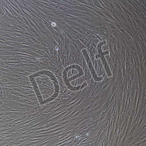 人原代主動脈外膜成纖維細胞