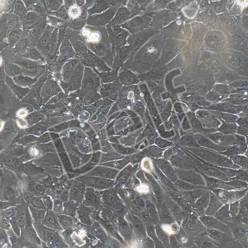 人原代子宮內(nèi)膜上皮細(xì)胞