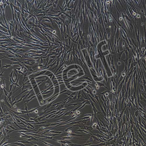 人子宮內膜上皮細胞永生化-sv40