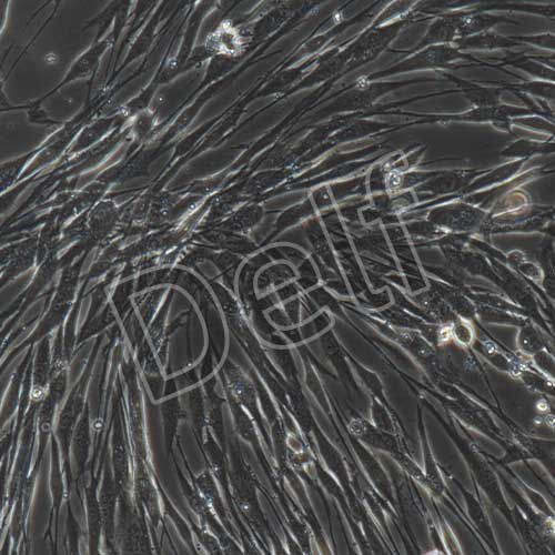 人子宮內膜上皮細胞永生化-sv40