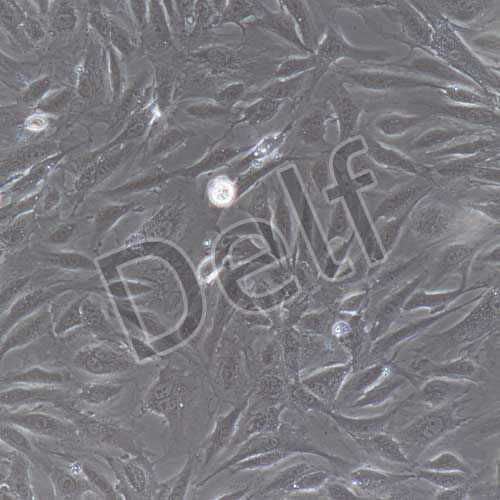 兔原代臍靜脈內(nèi)皮細(xì)胞