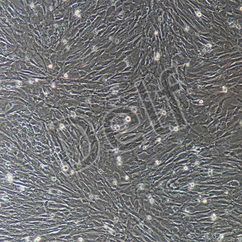 小鼠原代膀胱基質(zhì)成纖維細胞