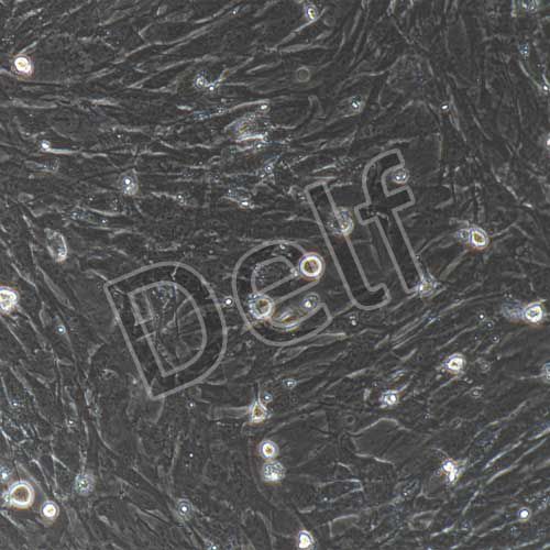 小鼠原代膀胱基質(zhì)成纖維細胞